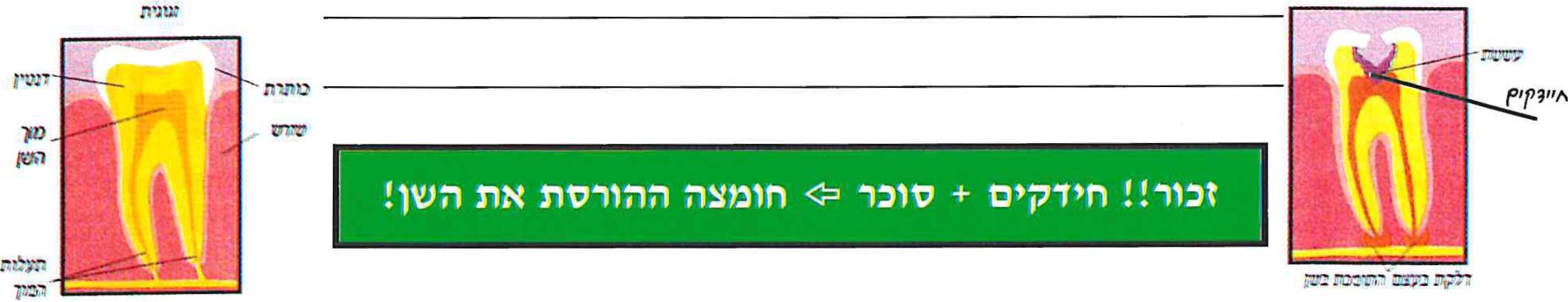 מימין:  דלקת בעצם התומכת בשן: עששת , חיידקים
משמאל: זגוגית: כותרת, שורש, דנטין, מוך השן, תעלות המוך
